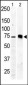 PKC beta2 Antibody (C-term)